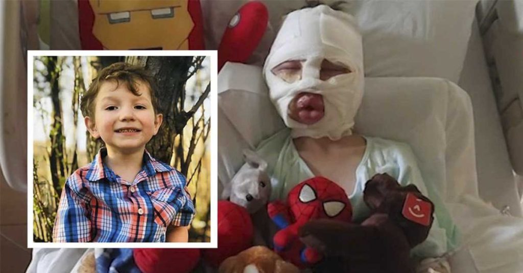 ‘Mommy They Lit Me on Fire': 6-Year-Old Burned in Horrific Bully Att...