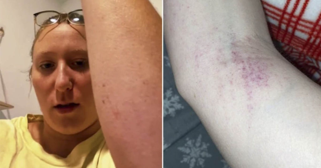 Woman shocked to discover tiny dots on skin were a sign of something w...